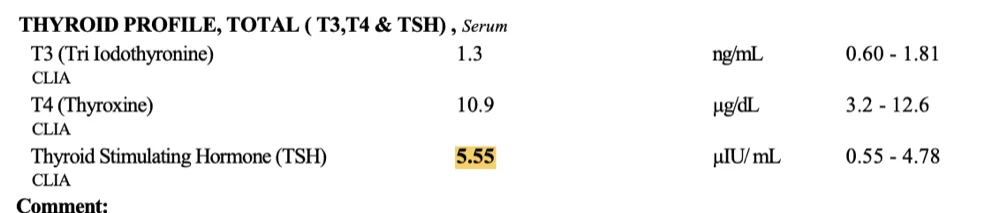 Amogh thyroid before