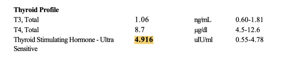 Nidhi thyroid before